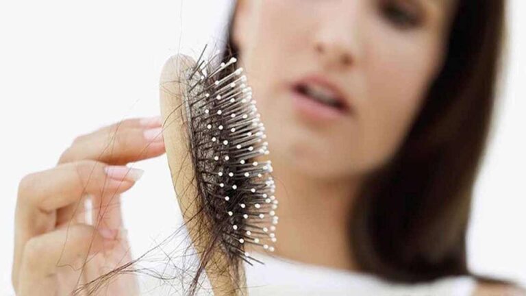 Thường xuyên rụng tóc nhiều là dấu hiệu của bệnh gì?