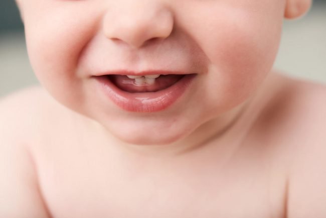 Trẻ bị thiếu răng phải làm sao?