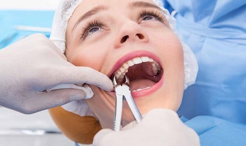 Tiểu phẫu răng khôn có đau không?