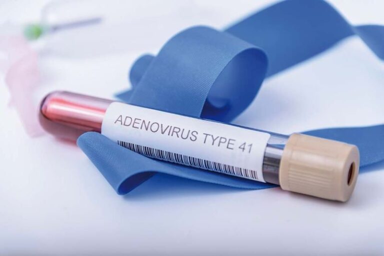 Có nên test nhanh adenovirus không?