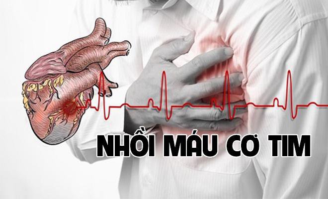 Huyết áp thấp gây bệnh nhồi máu cơ tim
