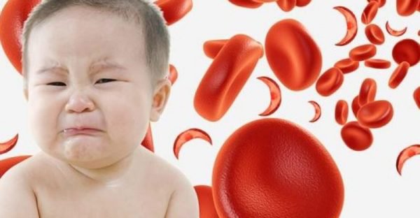 Trẻ bị thiếu máu gây ra các vấn đề nào?