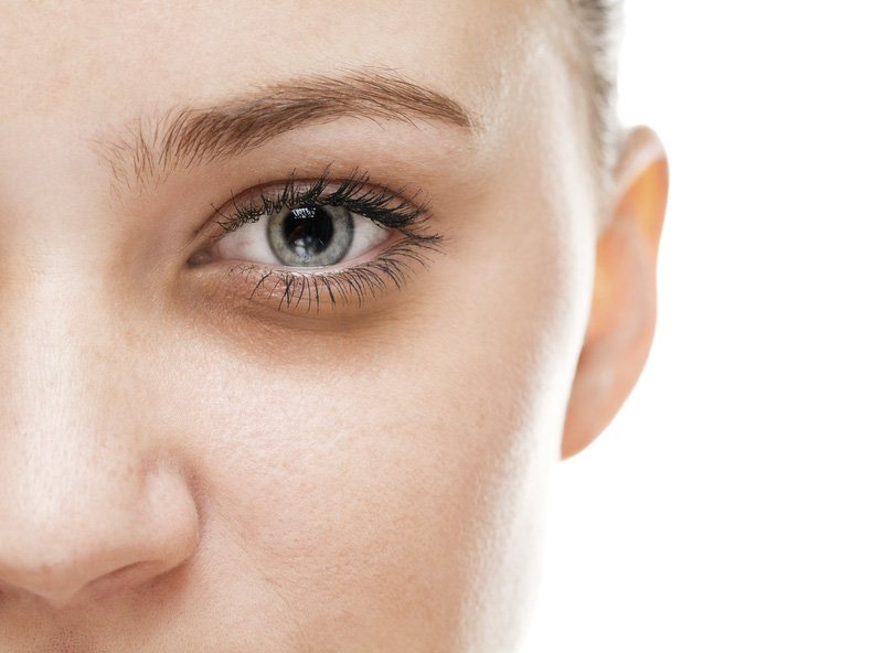 Mắt thâm quầng là biểu hiện của bệnh gì?