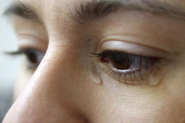 Chảy nước mắt sống là bệnh gì?