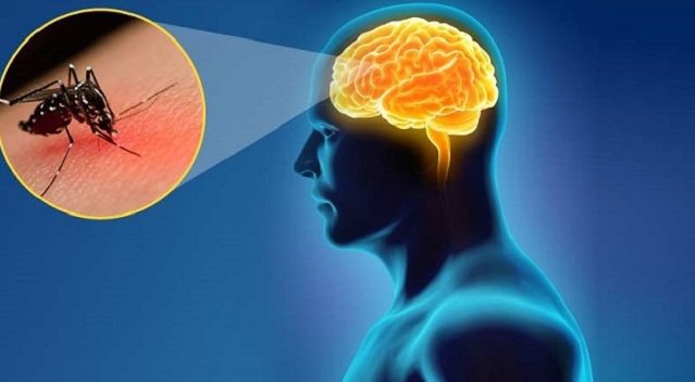 Tác nhân gây ra bệnh viêm não là gì?