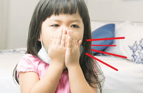 Viêm đường hô hấp trên ở trẻ em và cách tránh bệnh vào mùa lạnh