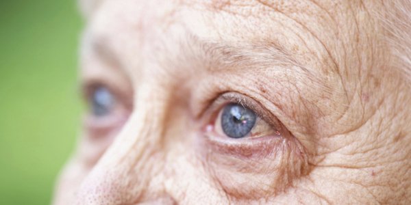 Nguyên nhân gây lão hóa mắt sớm