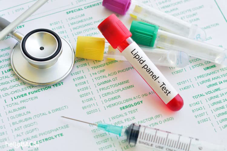 Các xét nghiệm rối loạn lipid máu