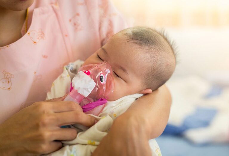 Điều trị tràn khí màng phổi ở trẻ sơ sinh