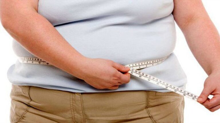 Bệnh béo phì và những điều bạn cần biết