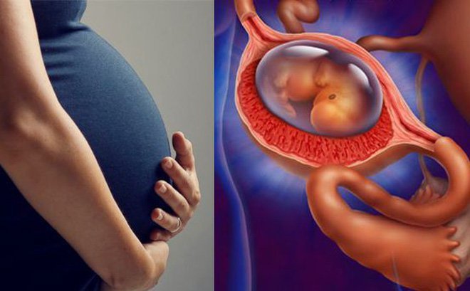 Mổ nội soi điều trị thai ngoài tử cung