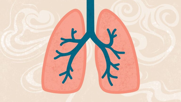 Dinh dưỡng cho bệnh nhân COPD (phổi tắc nghẽn mãn tính)