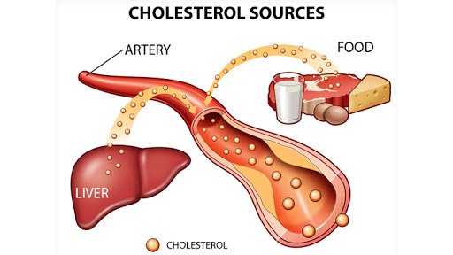 Mối liên hệ giữa cholesterol và sức khoẻ