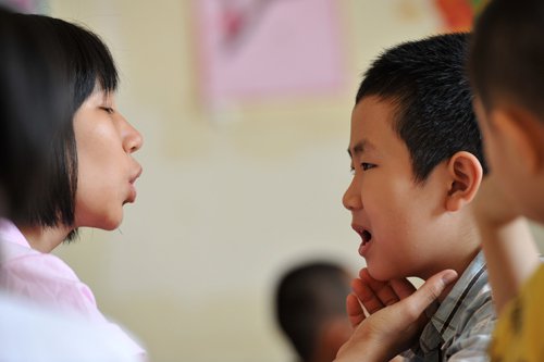 Trẻ nói ngọng: Nguyên nhân và cách điều trị hiệu quả
