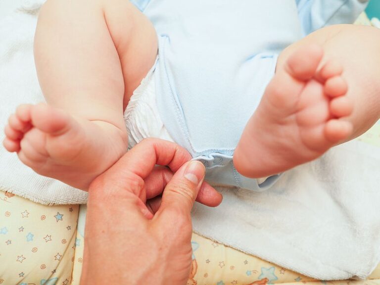 Có nên cắt bao quy đầu cho trẻ sơ sinh?