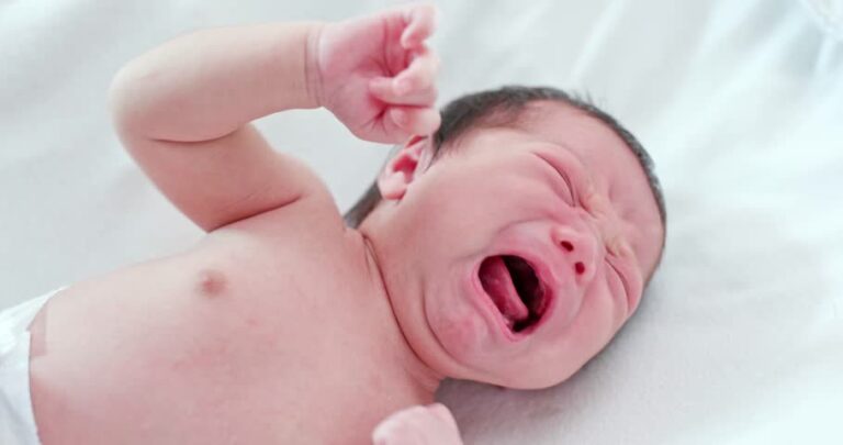 Nhận diện và xử trí nhiễm trùng rốn ở trẻ sơ sinh
