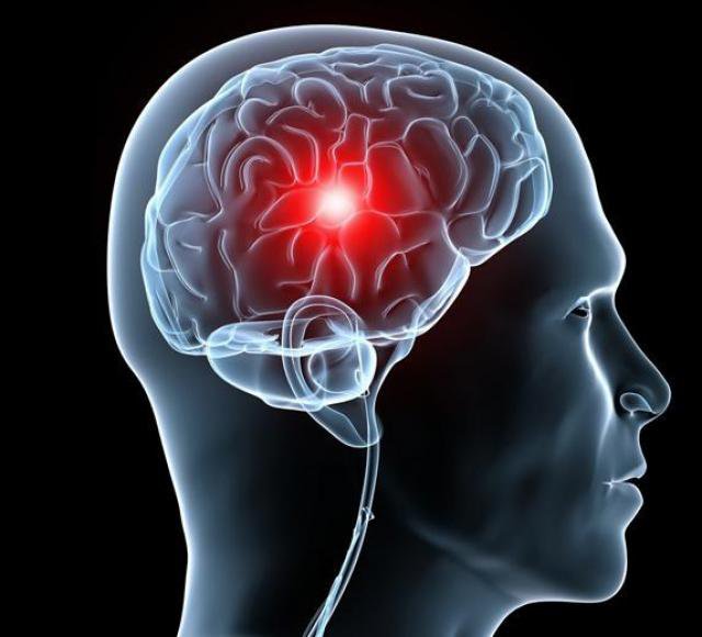 Chẩn đoán và điều trị tăng áp lực nội sọ não