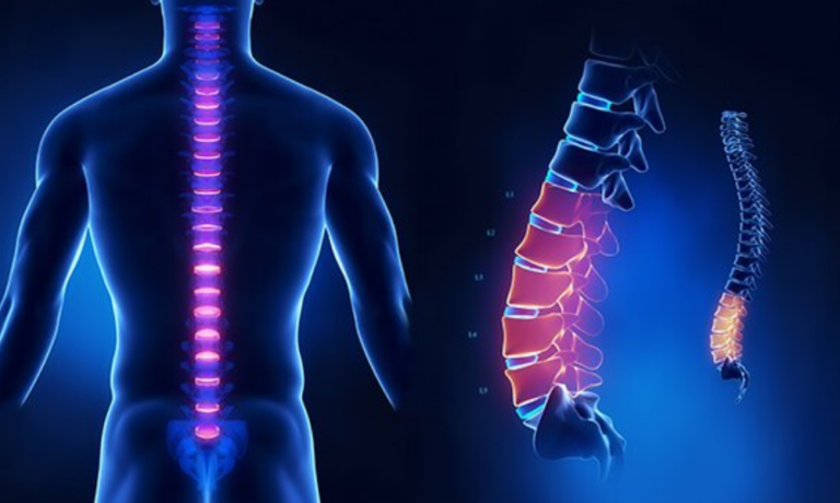 Trường hợp nào chỉ định chụp MRI cột sống thắt lưng? – P1