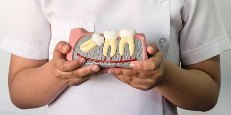 Vì sao trước khi nhổ răng khôn cần xét nghiệm máu? Những lưu ý khi nhổ răng khôn