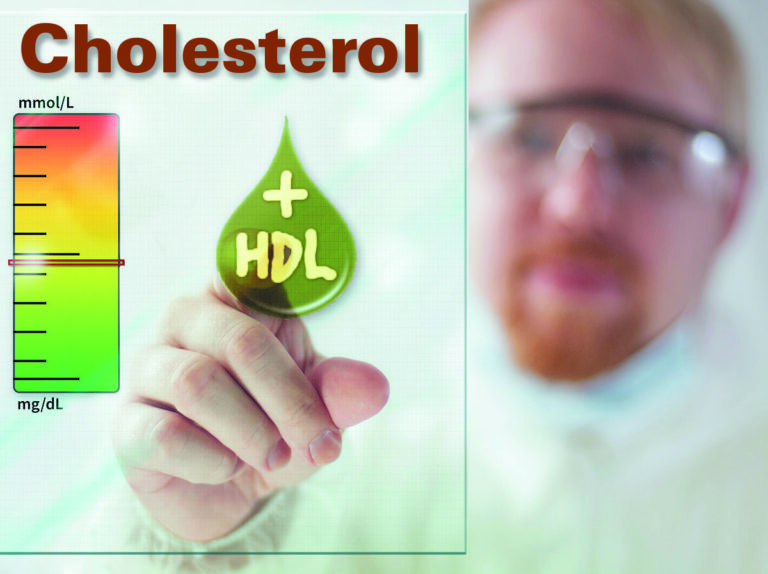 Tìm hiểu về xét nghiệm cholesterol toàn phần