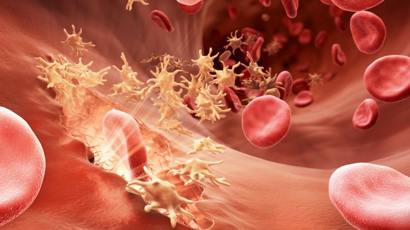 Các rối loạn đông máu có thể gặp trong hồi sức cấp cứu
