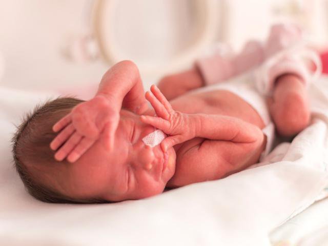 Trào ngược dạ dày thực quản ở trẻ sinh non
