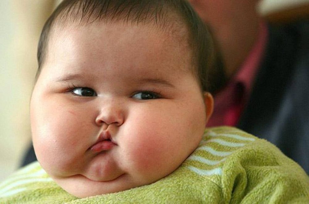 Trẻ em béo phì có nguy cơ mắc bệnh gì?