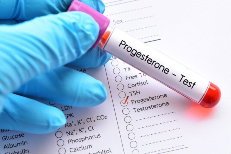 Hướng dẫn đọc kết quả xét nghiệm Progesterone