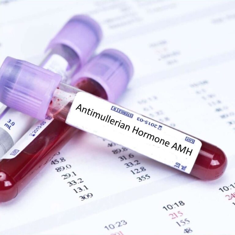 Vai trò của hormone AMH trong hỗ trợ sinh sản