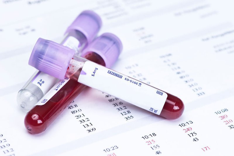 Những điều cần biết về xét nghiệm công thức máu