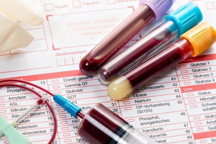 Ý nghĩa của các chỉ số xét nghiệm sinh hóa máu