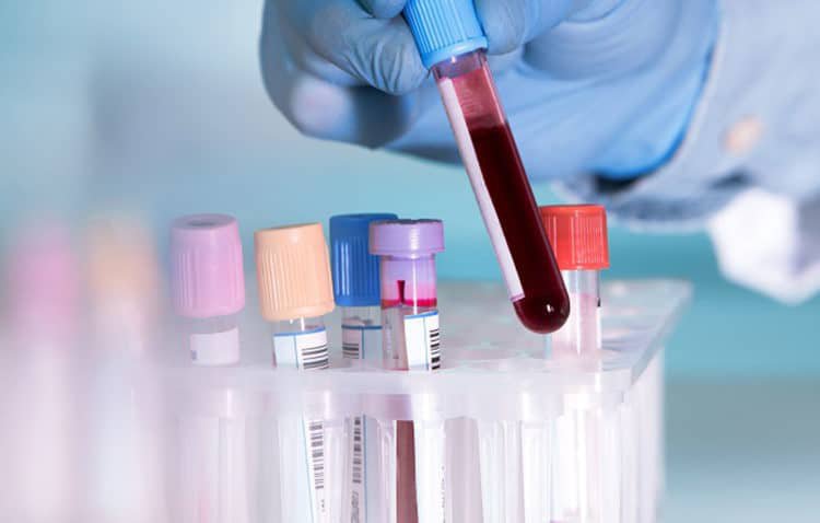 Tìm hiểu thêm xét nghiệm công thức máu toàn bộ