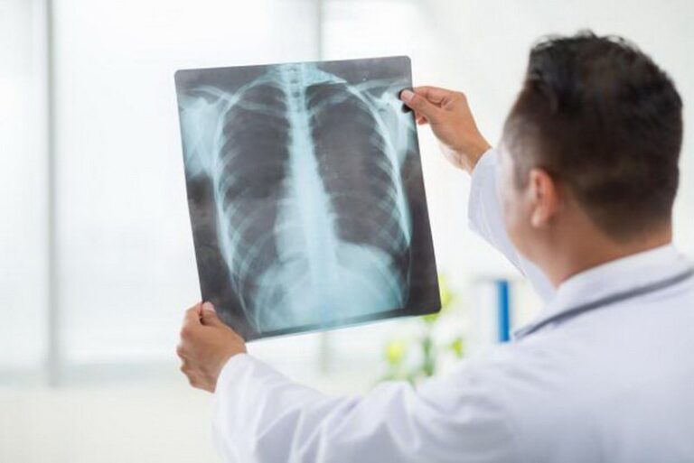 Chụp X-quang nhiều lần có gây nguy hiểm cho trẻ không?