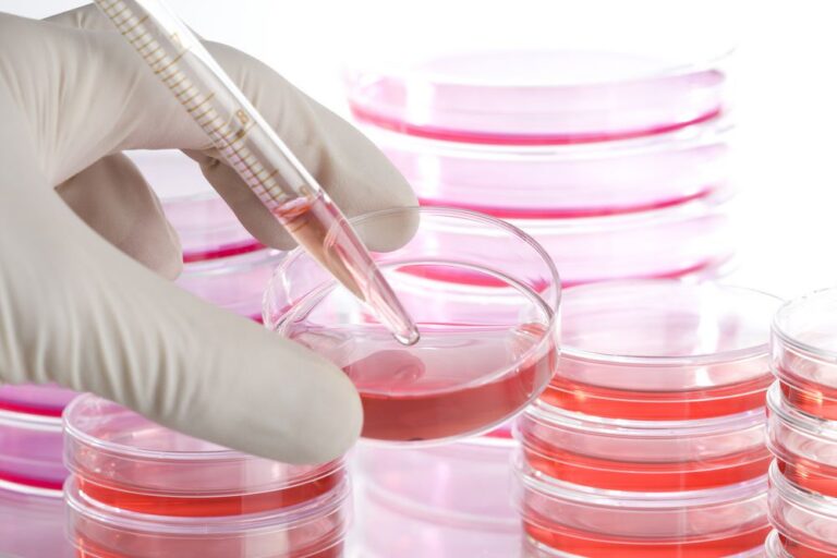 Dịch vụ lưu trữ tế bào gốc gồm những loại phí nào?