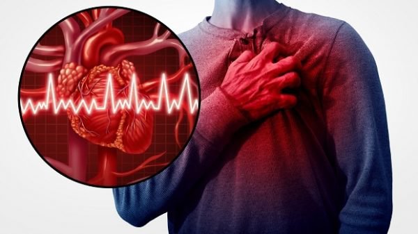 Phục hồi chức năng tim mạch cho bệnh nhân suy tim
