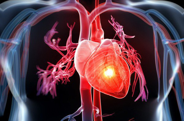 Bệnh lý tim mạch: nguyên nhân gây tử vong hàng đầu
