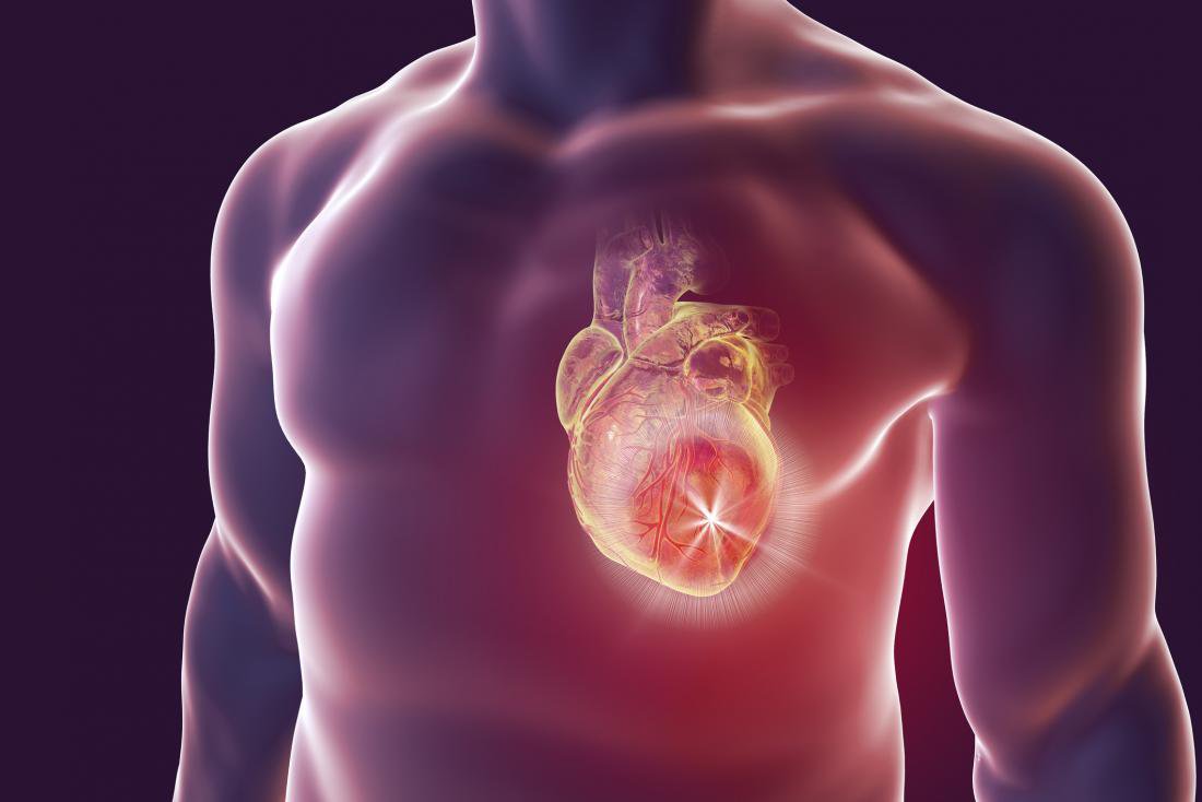 Các biến chứng tim mạch có thể gặp sau tổn thương não