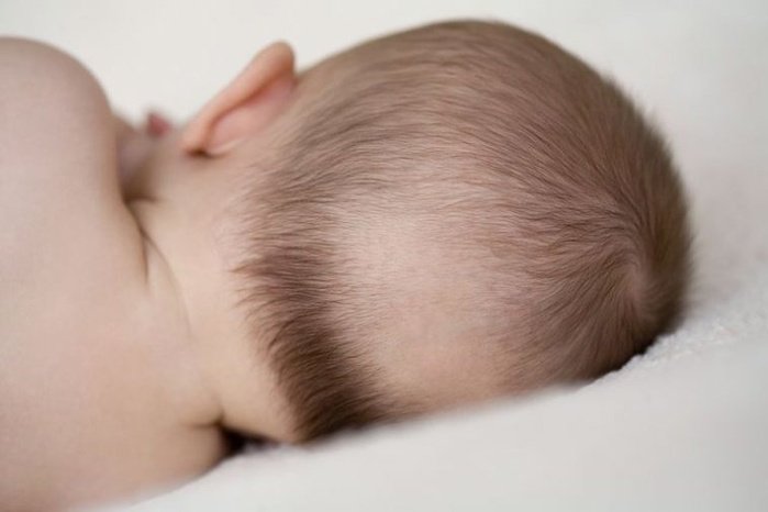 Trẻ 3 tháng tuổi rụng tóc, giật mình khi ngủ có nên bổ sung canxi không?