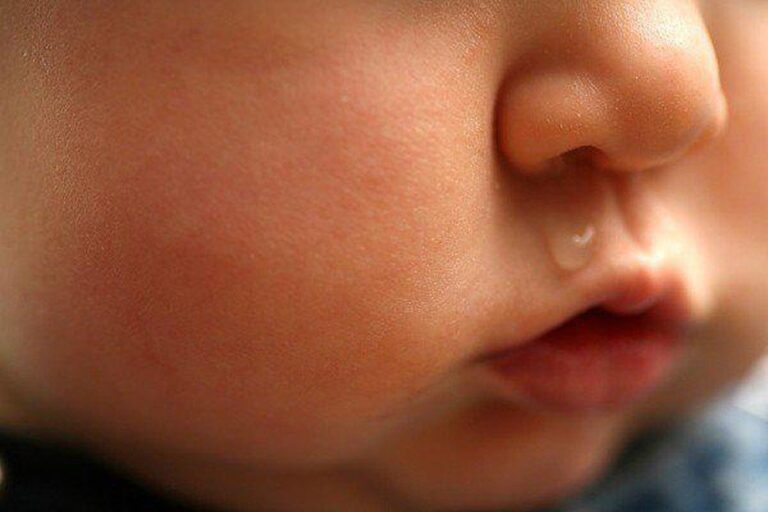 Trẻ 20 ngày tuổi khò khè kèm theo sổ mũi là dấu hiệu bệnh gì?