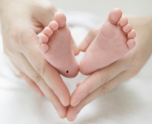 Mức độ thiếu men G6PD ở trẻ sơ sinh có kết quả xét nghiệm gót chân được 0,8 là bao nhiêu?