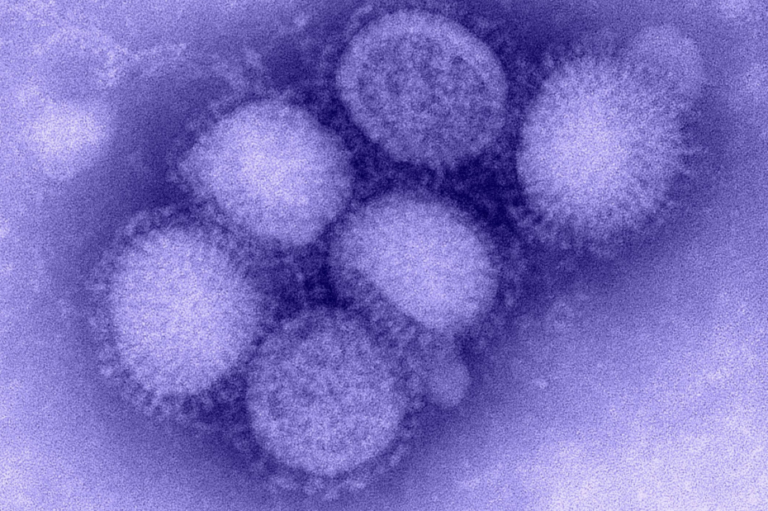 Virus cúm A/H1N1 chết ở nhiệt độ nào?