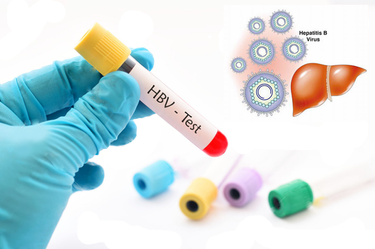 Có kết quả xét nghiệm HBsAb 13 UI/ml phải tiêm bao nhiêu mũi vắc-xin viêm gan B?