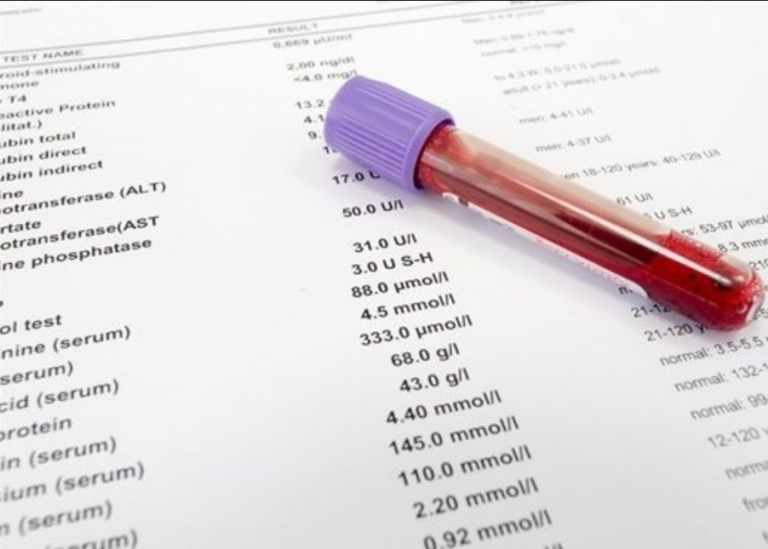 Cách đọc kết quả xét nghiệm nước tiểu và tổng phân tích tế bào máu ngoại vi