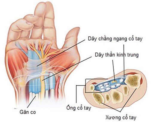 Dấu hiệu Tinel trong chẩn đoán hội chứng ống cổ tay